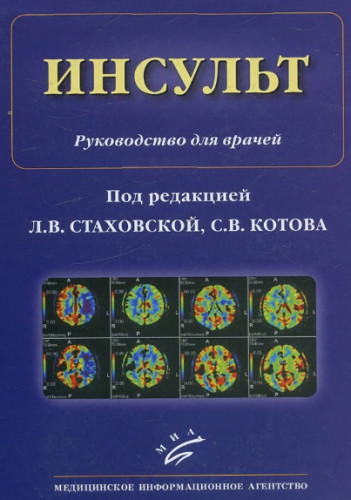 Сергей Котов. Инсульт. Руководство для врачей